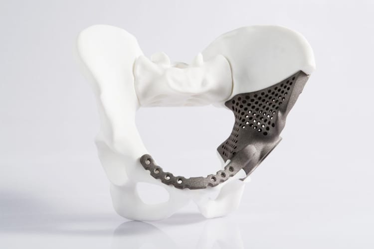 Additive Manufacturing in Medical field